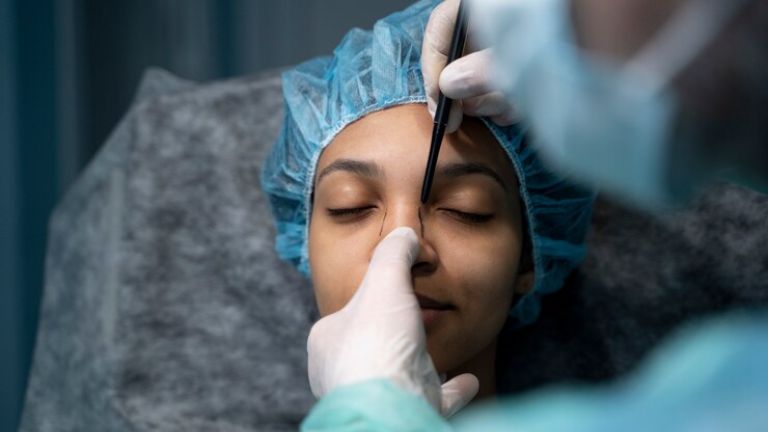 rinoplastia
